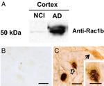 NGFR Antibody in Immunohistochemistry (IHC)