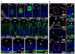 BrdU Antibody in Immunohistochemistry (IHC)