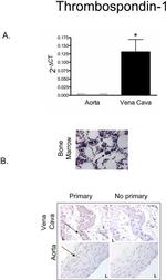 Thrombospondin 1 Antibody in Immunohistochemistry (Paraffin) (IHC (P))