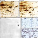 Cytokeratin 15 Antibody in Immunohistochemistry (IHC)