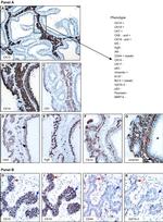 Cytokeratin 15 Antibody in Immunohistochemistry (IHC)