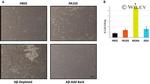 beta Amyloid Antibody in Neutralization (Neu)