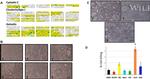 beta Amyloid Antibody in Neutralization (Neu)