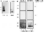 beta Amyloid Antibody in Western Blot (WB)