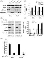 NFkB p65 Antibody in Western Blot (WB)