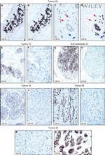 Cytokeratin 19 Antibody in Immunohistochemistry (IHC)
