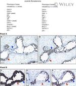 Cytokeratin 19 Antibody in Immunohistochemistry (IHC)