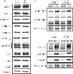 Phospho-IRS1 (Tyr612) Antibody in Western Blot (WB)