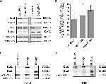 Desmoglein 3 Antibody in Immunoprecipitation (IP)