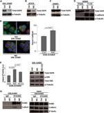 E-cadherin Antibody in Western Blot (WB)