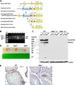 Metadherin Antibody in Immunohistochemistry (IHC)