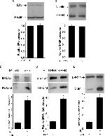 Estrogen Receptor alpha Antibody in Western Blot, Immunoprecipitation (WB, IP)