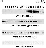 SNTB2 Antibody in Western Blot (WB)