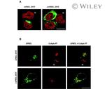 Golgin-97 Antibody in Immunocytochemistry (ICC/IF)