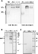 Apolipoprotein J Antibody in Western Blot (WB)