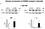 NMDAR1 Antibody in Western Blot (WB)