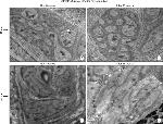 S100A1 Antibody in Immunohistochemistry (Paraffin) (IHC (P))