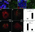 beta Catenin Antibody in Immunohistochemistry (IHC)