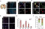 GFAP Antibody in Immunohistochemistry (IHC)