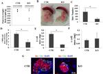 Insulin Antibody in Immunohistochemistry (IHC)