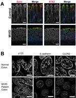 Claudin 2 Antibody in Immunohistochemistry (IHC)