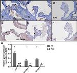 HIF1A Antibody in Immunohistochemistry (IHC)