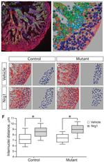 Cardiac Troponin T Antibody in Immunohistochemistry (IHC)