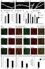 VGLUT1 Antibody in Immunohistochemistry (IHC)