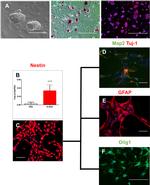 Nestin Antibody in Immunocytochemistry (ICC/IF)