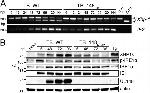 Phospho-IRE1 alpha (Ser724) Antibody in Western Blot (WB)