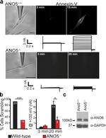 ANO6 Antibody in Western Blot (WB)