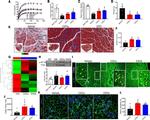 CD68 Antibody in Immunohistochemistry (IHC)