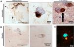 alpha Synuclein Antibody in Immunohistochemistry (IHC)