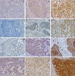 CCR4 Antibody in Immunohistochemistry (Paraffin) (IHC (P))