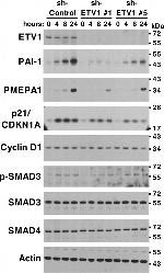 SMAD3 Antibody in Western Blot (WB)