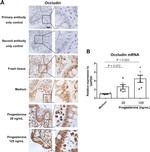 Occludin Antibody in Immunohistochemistry (IHC)