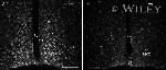 CD282 (TLR2) Antibody in Immunocytochemistry (ICC/IF)