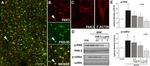 Phospho-PAK1/2/3 (Ser141) Antibody in Western Blot (WB)