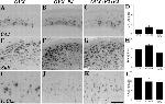 beta Amyloid Antibody in Immunohistochemistry (IHC)