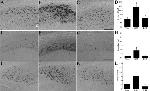 beta Amyloid Antibody in Immunohistochemistry, Immunohistochemistry - Free Floating (IHC, IHC (Free))