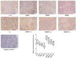 SOCS1 Antibody in Immunohistochemistry (IHC)