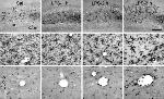 Phospho-Tau (Ser202, Thr205) Antibody in Immunohistochemistry (IHC)