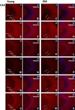 GABRA5 Antibody in Immunohistochemistry (IHC)