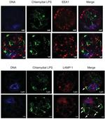 EEA1 Antibody in Immunocytochemistry (ICC/IF)