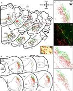 TRITC Antibody in Immunohistochemistry (IHC)