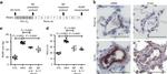 Alpha-Smooth Muscle Actin Antibody in Immunohistochemistry (IHC)