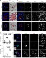 Alpha-Smooth Muscle Actin Antibody in Immunocytochemistry (ICC/IF)