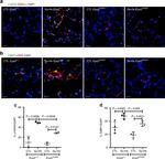 Alpha-Smooth Muscle Actin Antibody in Immunocytochemistry (ICC/IF)