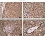 c-Met Antibody in Immunohistochemistry (IHC)