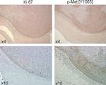 Phospho-c-Met (Tyr1003) Antibody in Immunohistochemistry (IHC)